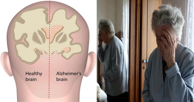 Должны прочесть: 9 привычек, которые вам нужно знать, чтобы остановить деменцию и болезнь Альцгеймера, прежде чем они начнут развиваться!