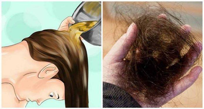 5 причин выпадения волос у женщин и естественные лекарства от этого!