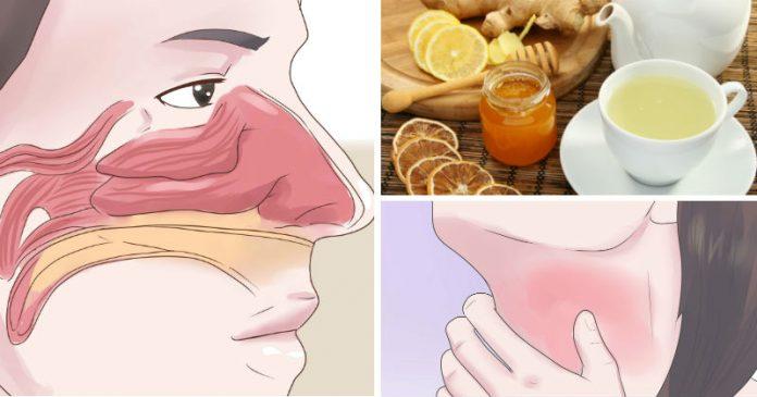 3 легких рецепта напитков, которые очищают синусы и мгновенно уничтожают воспаление горла!