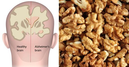 Орех, который помогает бороться с депрессией и болезнью Альцгеймера