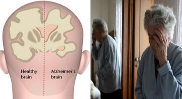 Должны прочесть: 9 привычек, которые вам нужно знать, чтобы остановить деменцию и болезнь Альцгеймера, прежде чем они начнут развиваться!
